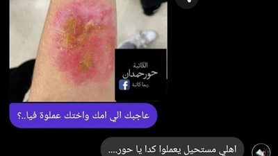 جرح قريب حكاوي بقلم حور حمدان